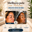 Peeling Rose De Mer Christina