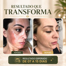 Peeling de Algas Bodyaga Importado | Esfoliação Natural | Auxilia na Uniformidade da Pele